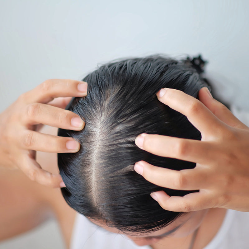 5 TIPS TO TAKE CARE OF OILY HAIR